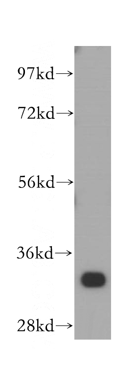MCF7 cells were subjected to SDS PAGE followed by western blot with Catalog No:108165(ARPC2 antibody) at dilution of 1:400