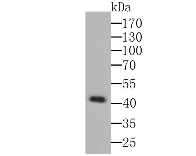 Fig1: Western blot analysis of Osteoprotegerin on K562 cell lysate using anti-Osteoprotegerin antibody at 1/1000 dilution.