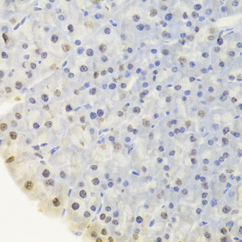 Immunohistochemistry - DOK1 Polyclonal Antibody 