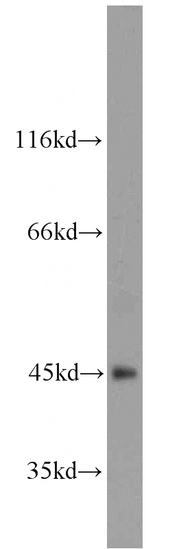mouse testis tissue were subjected to SDS PAGE followed by western blot with Catalog No:108205(ART5 antibody) at dilution of 1:300