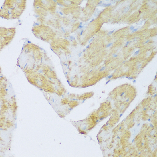 Immunohistochemistry - DENR Polyclonal Antibody 