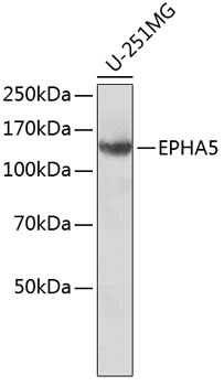 Western blot - EPHA5 Monoclonal Antibody 