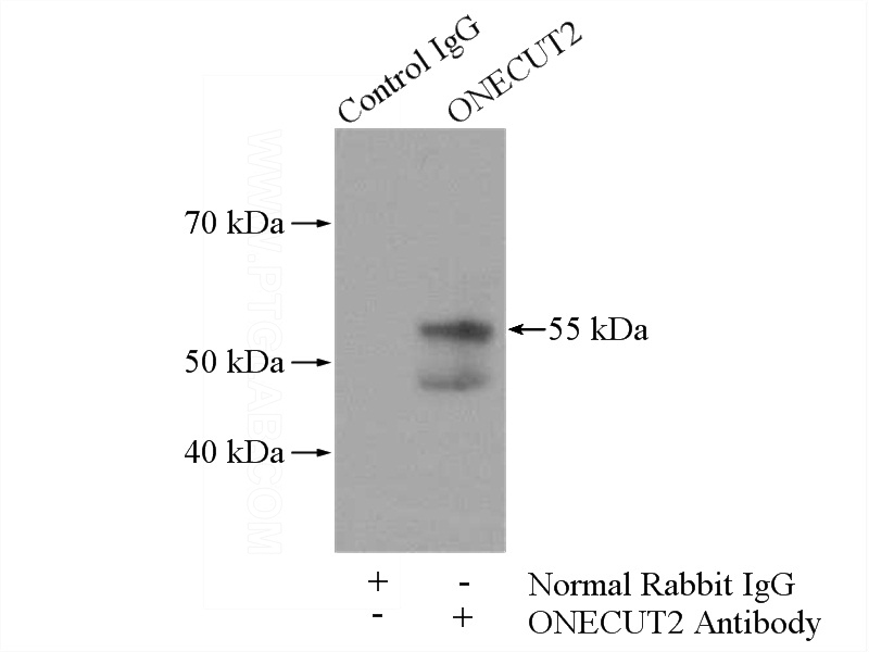 IP Result of anti-ONECUT2 (IP:Catalog No:113350, 4ug; Detection:Catalog No:113350 1:300) with HEK-293 cells lysate 3200ug.
