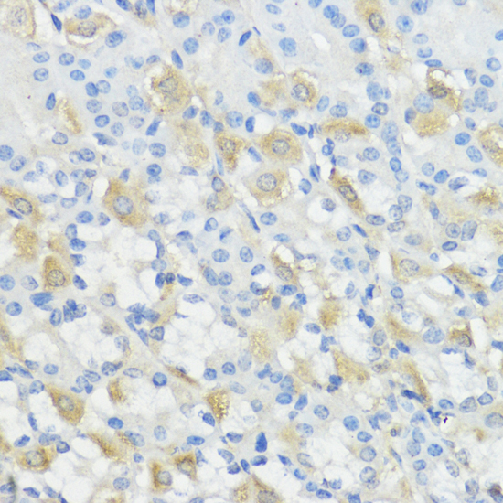 Immunohistochemistry - GPX2 Polyclonal Antibody 