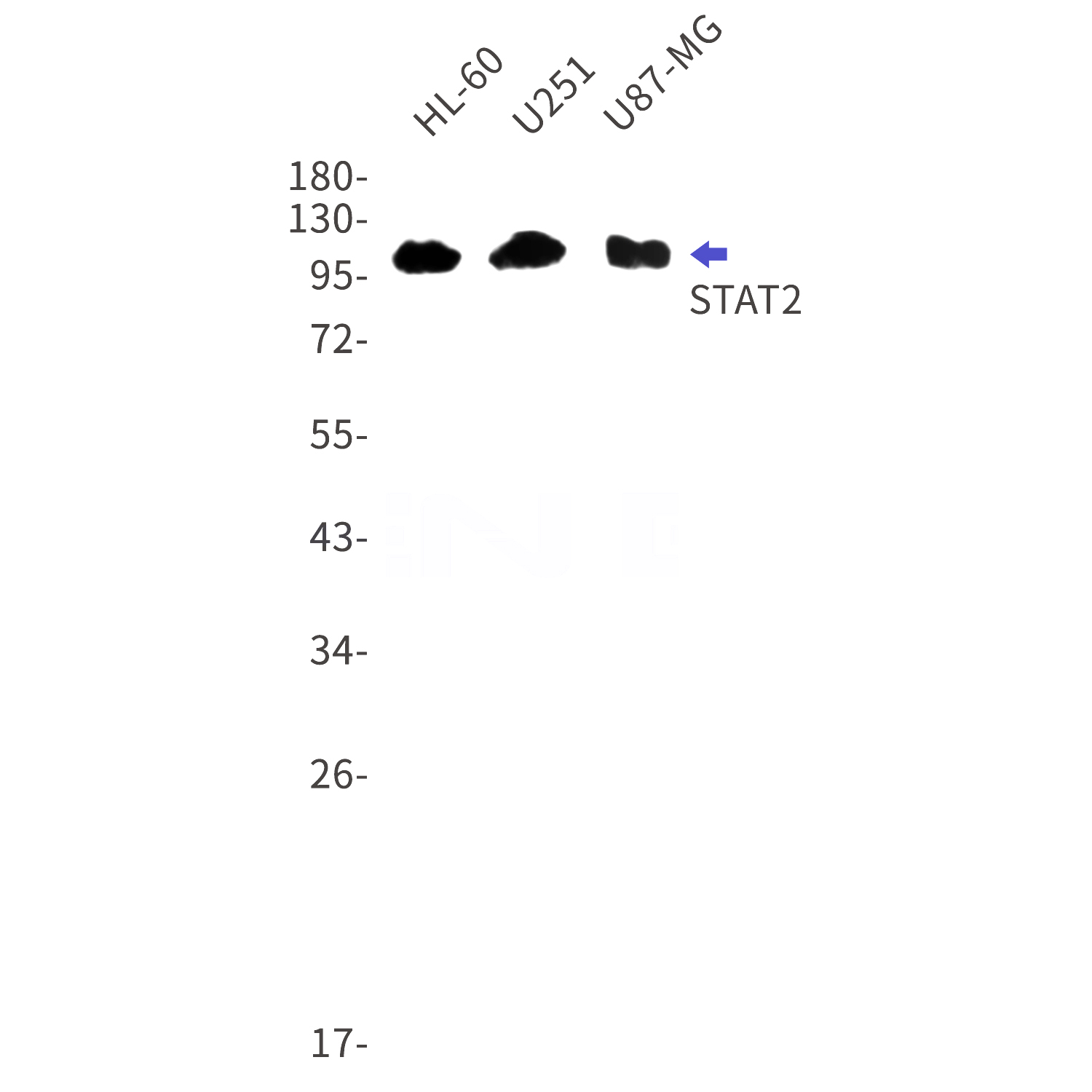 Western blot detection of STAT2 in HL-60,U251,U87-MG cell lysates using STAT2 Rabbit mAb(1:1000 diluted).Predicted band size:105kDa.Observed band size:113kDa.