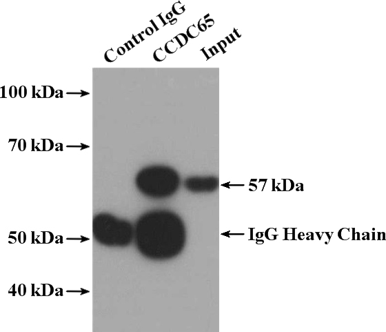 IP Result of anti-CCDC65 (IP:Catalog No:108984, 4ug; Detection:Catalog No:108984 1:1000) with mouse testis tissue lysate 4000ug.