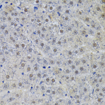 Immunohistochemistry - SNRPA Polyclonal Antibody 