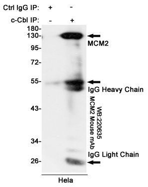 Immunoprecipitation analysis of Hela cell lysates using MCM2 mouse mAb.