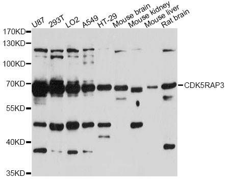 Western blot - CDK5RAP3 Polyclonal Antibody 