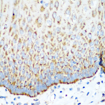 Immunohistochemistry - MTCO2 Polyclonal Antibody 