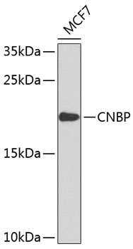 Western blot - CNBP Polyclonal Antibody 