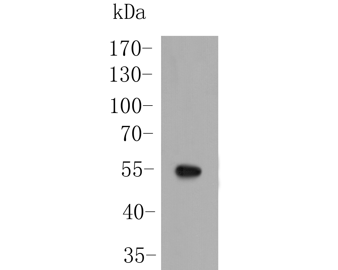 Fig1:; Western blot analysis of SARS2 on Zebrafish tissue lysate. Proteins were transferred to a PVDF membrane and blocked with 5% BSA in PBS for 1 hour at room temperature. The primary antibody ( 1/500) was used in 5% BSA at room temperature for 2 hours. Goat Anti-Rabbit IgG - HRP Secondary Antibody (HA1001) at 1:5,000 dilution was used for 1 hour at room temperature.