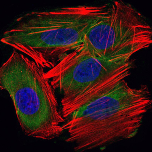 Immunofluorescence analysis of HepG2 cells using UBE2I mouse mAb (green). Blue: DRAQ5 fluorescent DNA dye. Red: Actin filaments have been labeled with Alexa Fluor-555 phalloidin.