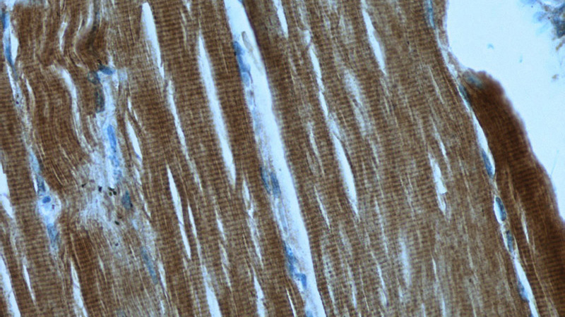 Immunohistochemistry of paraffin-embedded human skeletal muscle slide using Catalog No:107704(ACTA1-Specific Antibody) at dilution of 1:50