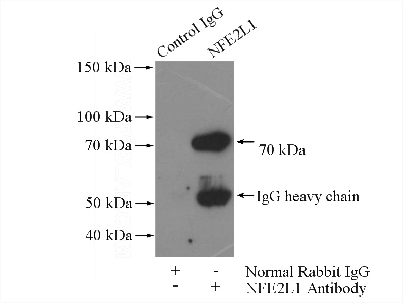 IP Result of anti-NFE2L1 (IP:Catalog No:113146, 4ug; Detection:Catalog No:113146 1:500) with mouse skeletal muscle tissue lysate 2200ug.