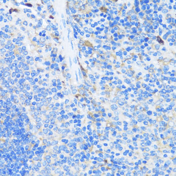 Immunohistochemistry - EIF3J Polyclonal Antibody 