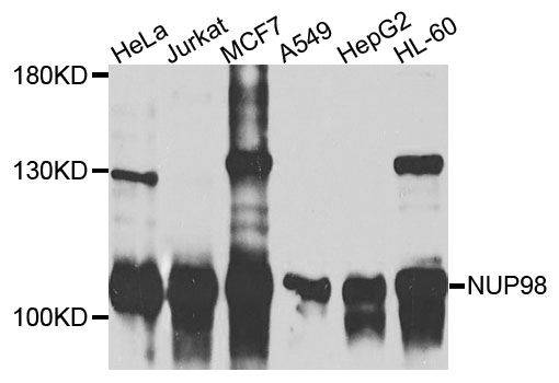 Western blot - NUP98 Monoclonal Antibody 
