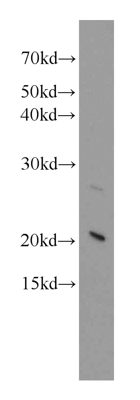 HEK-293 cells were subjected to SDS PAGE followed by western blot with Catalog No:111702(HSPB8 antibody) at dilution of 1:400