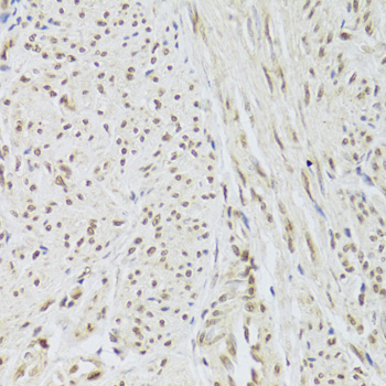 Immunohistochemistry - SNRPA Polyclonal Antibody 