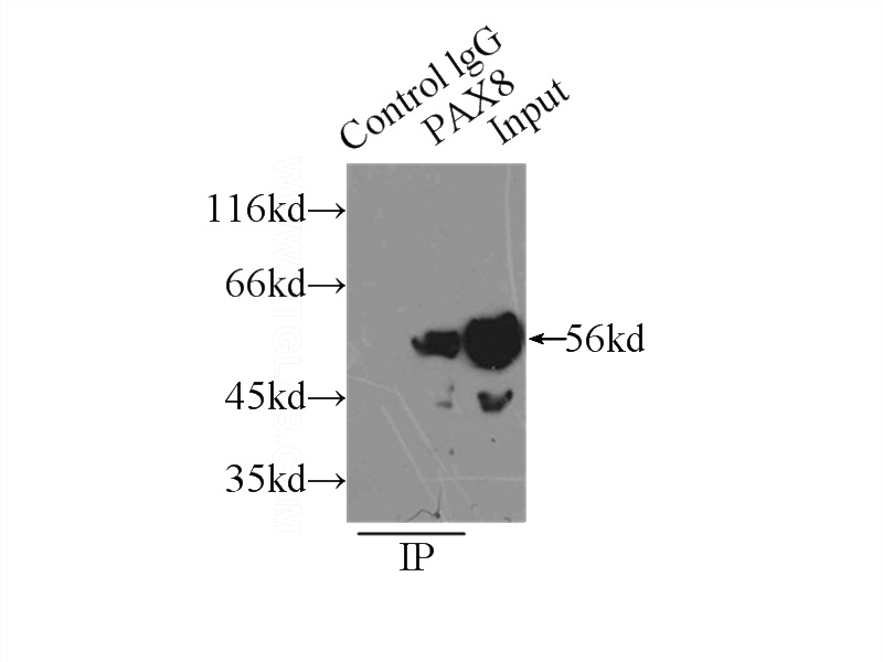 IP Result of anti-pan-PAX (IP:Catalog No:113572, 3ug; Detection:Catalog No:113572 1:800) with SKOV-3 cells lysate 2500ug.
