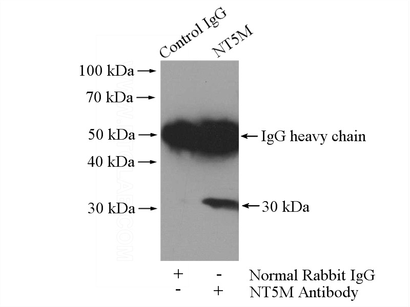 IP Result of anti-NT5M (IP:Catalog No:113397, 4ug; Detection:Catalog No:113397 1:600) with mouse skeletal muscle tissue lysate 2200ug.