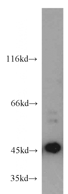 A375 cells were subjected to SDS PAGE followed by western blot with Catalog No:112377(MAGEA1 antibody) at dilution of 1:200