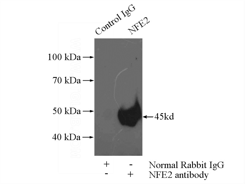 IP Result of anti-NFE2 (IP:Catalog No:113144, 4ug; Detection:Catalog No:113144 1:500) with K-562 cells lysate 3440ug.