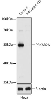Western blot - PRKAR2A Polyclonal Antibody 