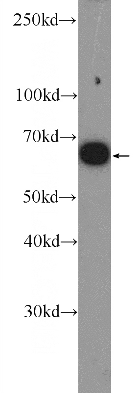 MCF-7 cells were subjected to SDS PAGE followed by western blot with Catalog No:110397(ER Antibody) at dilution of 1:1000