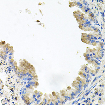 Immunohistochemistry - PI3 Kinase p110 beta Polyclonal Antibody 