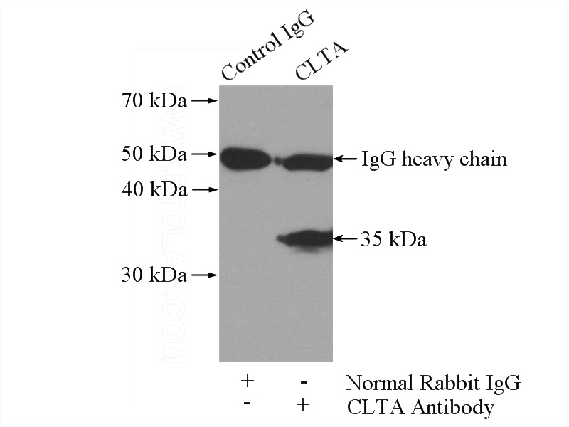 IP Result of anti-CLTA (IP:Catalog No:109405, 4ug; Detection:Catalog No:109405 1:800) with mouse brain tissue lysate 4000ug.