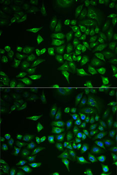 Immunofluorescence - PLA2G2D Polyclonal Antibody 