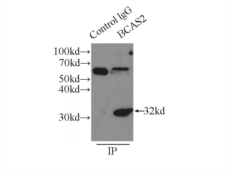 IP Result of anti-BCAS2 (IP:Catalog No:108380, 3ug; Detection:Catalog No:108380 1:1000) with mouse brain tissue lysate 6500ug.