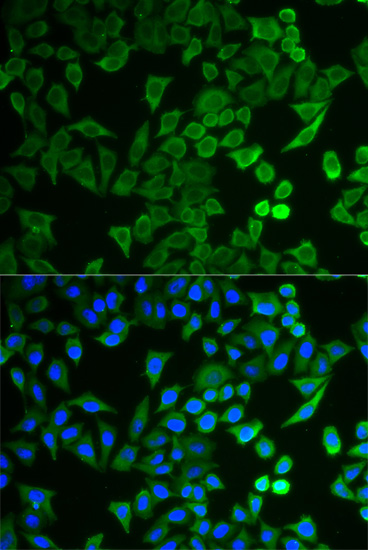 Immunofluorescence - NPRL2 Polyclonal Antibody 