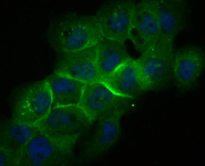 Fig2:; ICC staining of Galectin 8 in A431 cells (green). Formalin fixed cells were permeabilized with 0.1% Triton X-100 in TBS for 10 minutes at room temperature and blocked with 1% Blocker BSA for 15 minutes at room temperature. Cells were probed with the primary antibody ( 1/50) for 1 hour at room temperature, washed with PBS. Alexa Fluor®488 Goat anti-Rabbit IgG was used as the secondary antibody at 1/1,000 dilution. The nuclear counter stain is DAPI (blue).