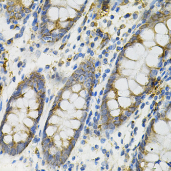 Immunohistochemistry - DEFB132 Polyclonal Antibody 