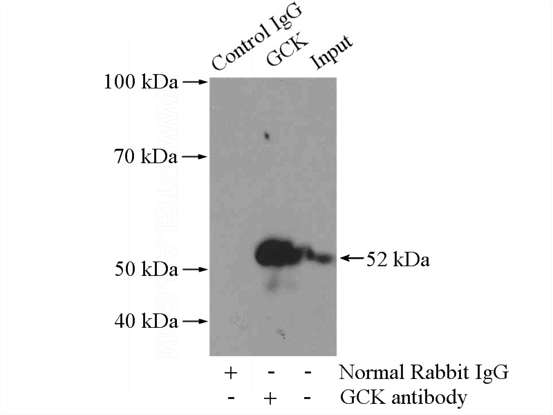 IP Result of anti-GCK (IP:Catalog No:110905, 4ug; Detection:Catalog No:110905 1:800) with mouse liver tissue lysate 4000ug.