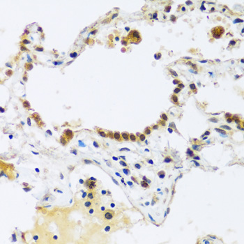 Immunohistochemistry - ARL6IP4 Polyclonal Antibody 