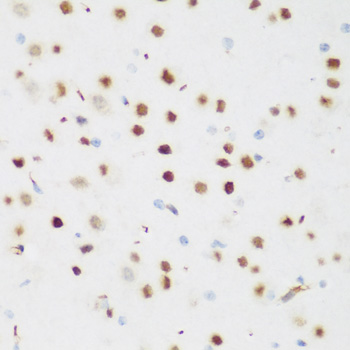 Immunohistochemistry - CSRNP1 Polyclonal Antibody 