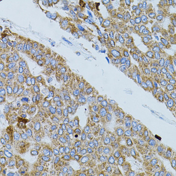 Immunohistochemistry - GNA13 Polyclonal Antibody 