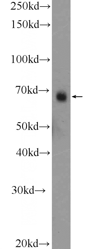 RAW 264.7 cells were subjected to SDS PAGE followed by western blot with Catalog No:113610(PXN Antibody) at dilution of 1:300