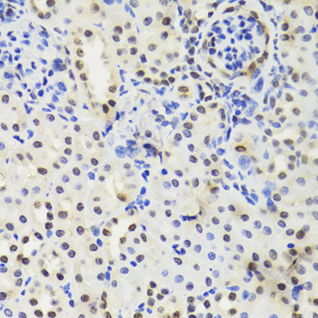 Immunohistochemistry - EFTUD2 Polyclonal Antibody 