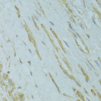 Immunohistochemistry - IFT57 Polyclonal Antibody 