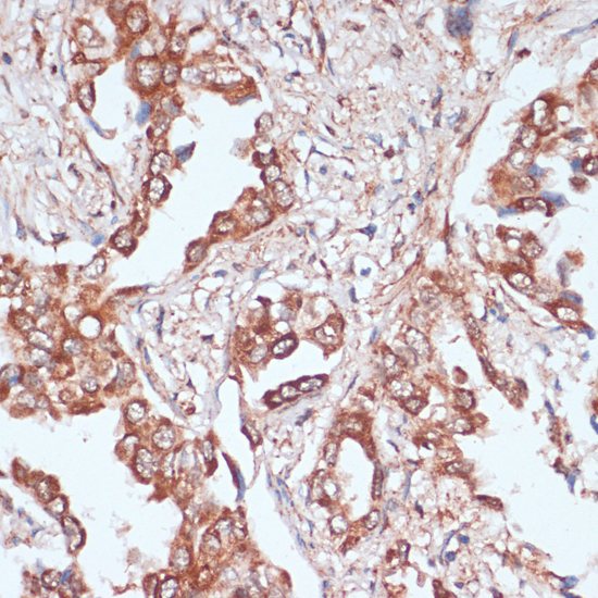 Immunohistochemistry - ACAT1 Polyclonal Antibody 