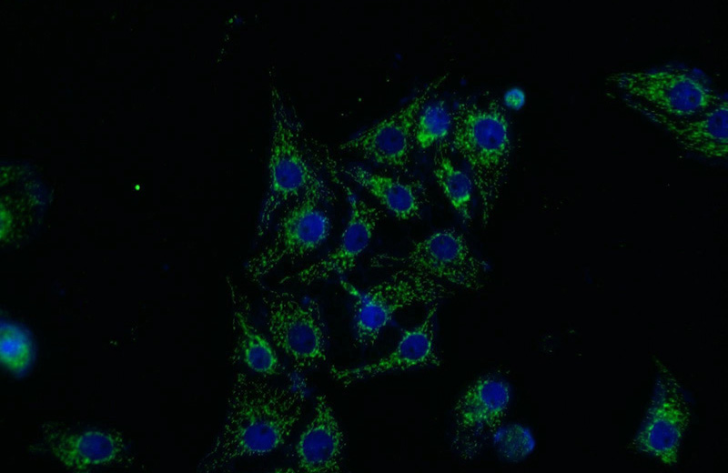 Immunofluorescent analysis of SH-SY5Y cells using Catalog No:108209(ASAH1 Antibody) at dilution of 1:25 and Alexa Fluor 488-congugated AffiniPure Goat Anti-Rabbit IgG(H+L)