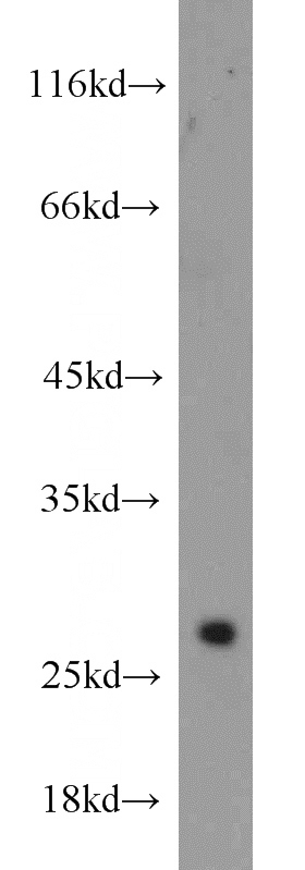 Jurkat cells were subjected to SDS PAGE followed by western blot with Catalog No:116744(VGLL1 antibody) at dilution of 1:1000