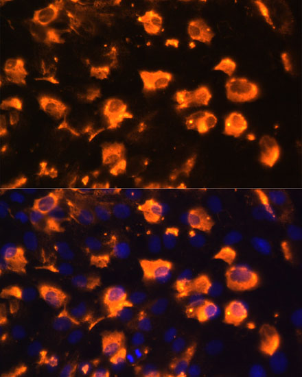 Immunofluorescence - JAG2 Polyclonal Antibody 