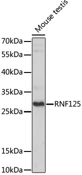 Western blot - RNF125 Polyclonal Antibody 