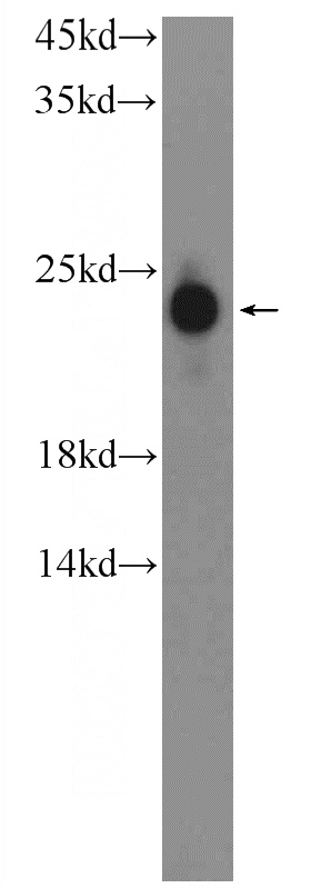 Jurkat cells were subjected to SDS PAGE followed by western blot with Catalog No:109019(CD3D antibody) at dilution of 1:800