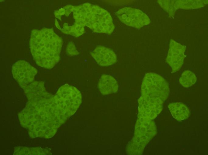 Fig3: ICC staining cMet in Hela cells (green). Cells were fixed in paraformaldehyde, permeabilised with 0.25% Triton X100/PBS.